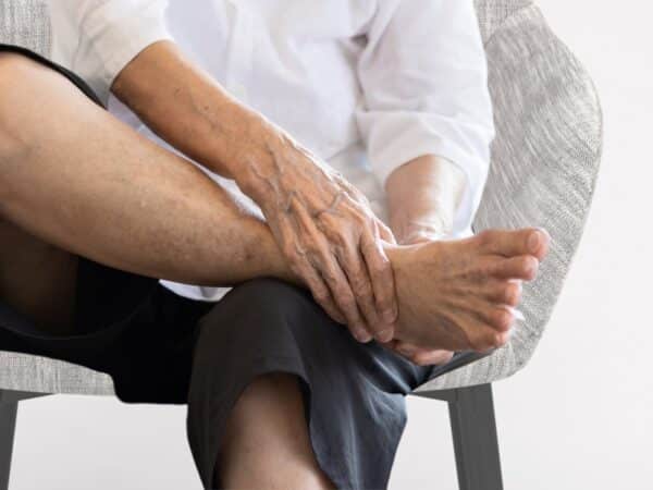 Imaginea unei persoane in varsta cu boala Paget